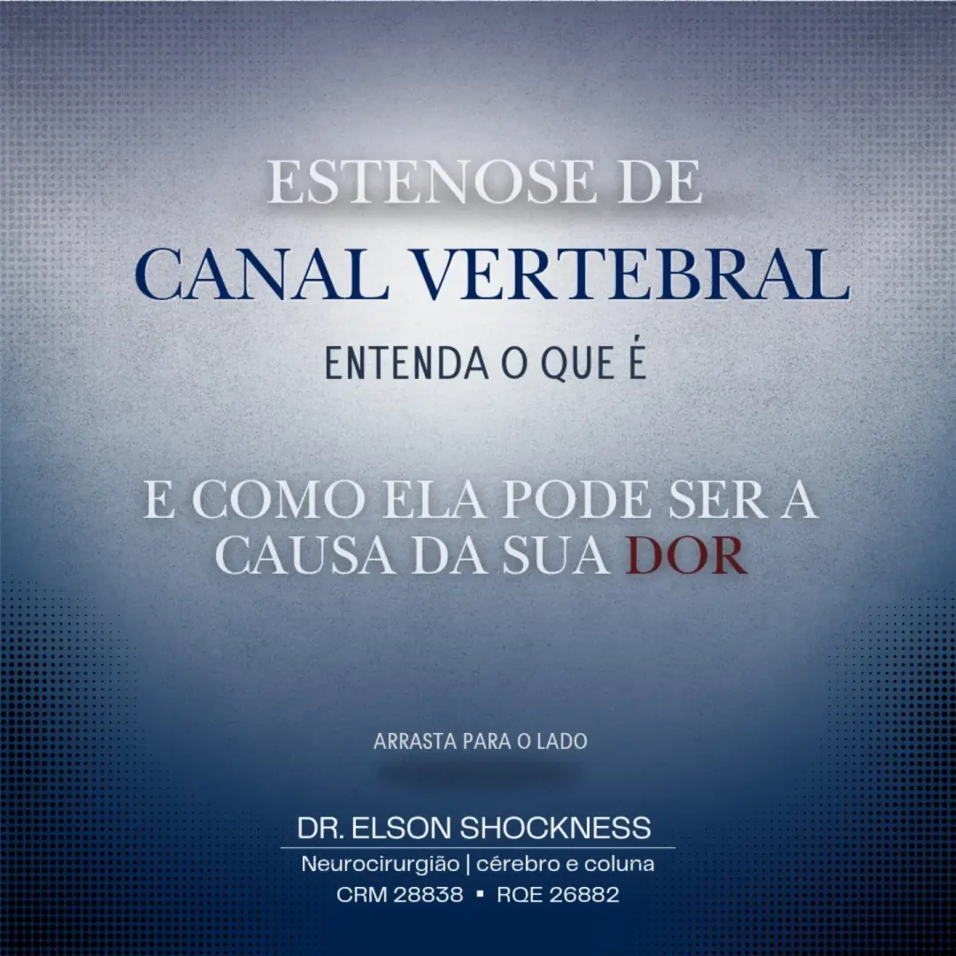 A estenose de canal vertebral pode limitar a rotina e a qualidade de vida, mas com diagnóstico precoce é possível… (imagem 1 de 2)